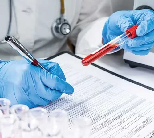 albumin-e Albümin testi