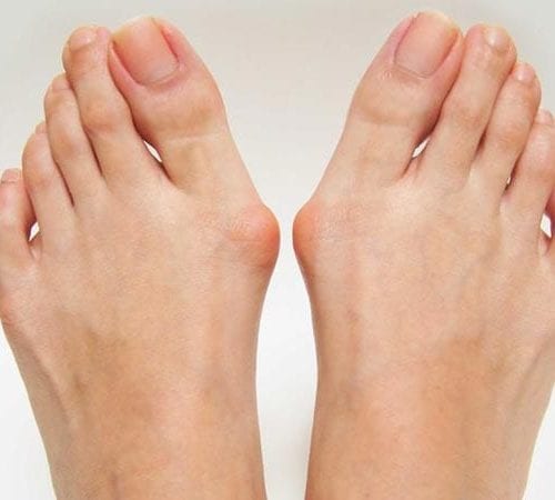 Ayak Şekil Bozuklukları