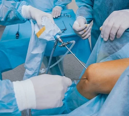 bag-ve-meniskus-yirtilmasi-yaralanmasi-e Bağ ve Menisküs Yırtılması – Yaralanması Tedavisi