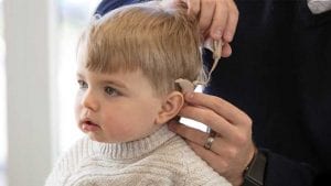 عمليات زراعة قوقعة الأذن (Cochlear implants)