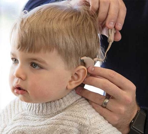عمليات زراعة قوقعة الأذن (Cochlear implants)