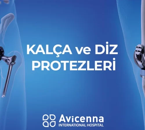 diz-ve-kalca-protezleri-e Diz ve kalça protezleri