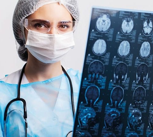 لورم الدبقي (Glioma)