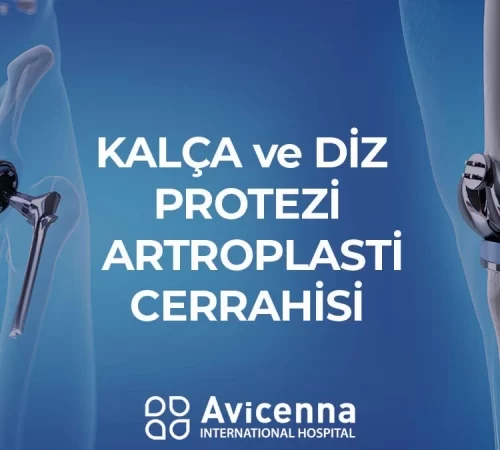 kalca-ve-diz-protezi-artroplasti-cerrahisi-e Kalça ve diz protezi artroplasti cerrahisi