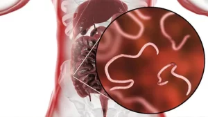 Kıl Kurdu (Bağırsak Kurdu) görünümü