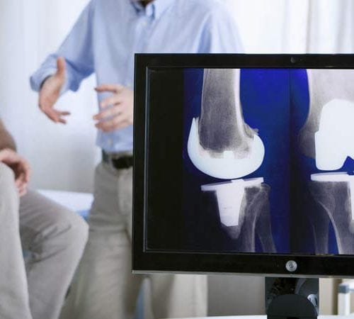 جراحة استبدال الركبة