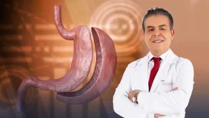 Obezite (Şişmanlık) Tedavi Yöntemleri