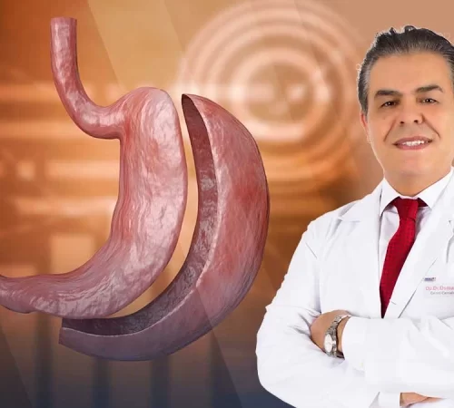 obezite-tedavisi-m Obezite (Şişmanlık) Tedavi Yöntemleri