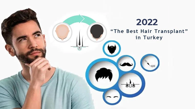 2025 The Best Hair Transplant in Turkey