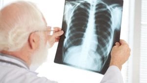 Белодробни заболявания