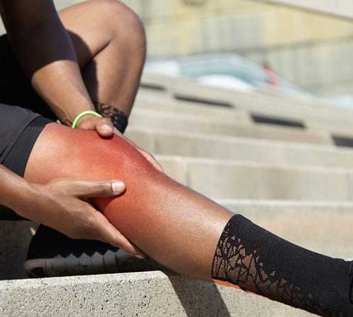 إصابة الرباط الصليبي الأمامي (ACL)