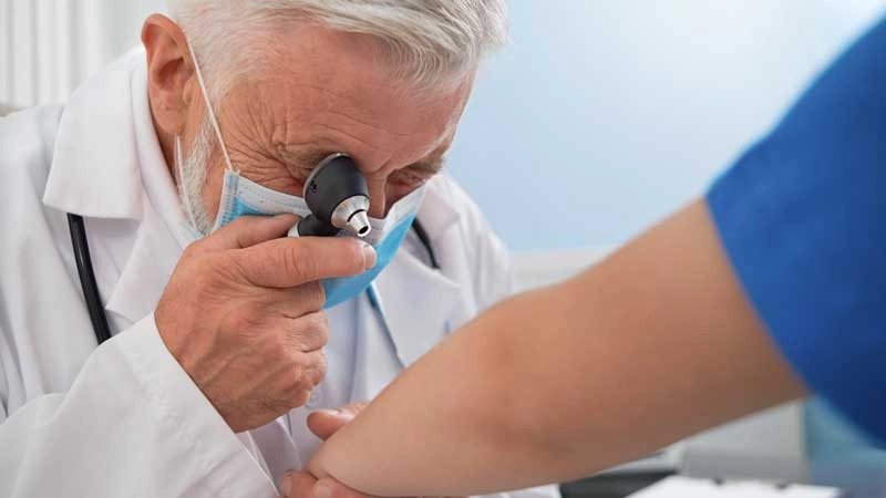 behçet hastalığı tanısı için cilt kontrolü yapan doktor