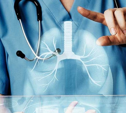 تنظير القَصَبات (Bronchoscopy)