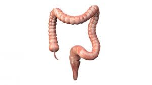 فغر القولون (Colostomy)