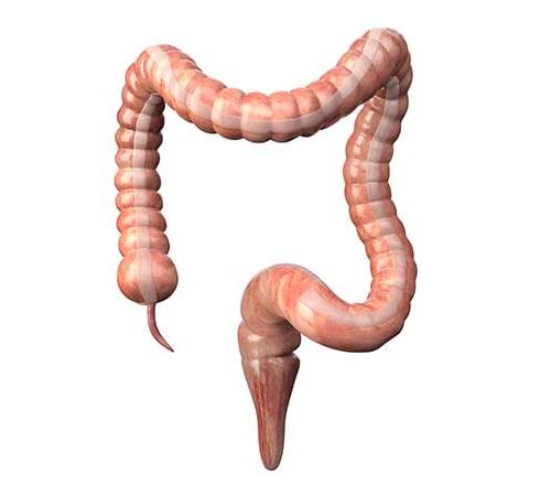 فغر القولون (Colostomy)