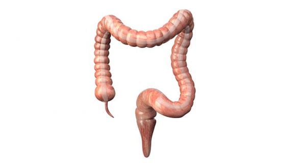 فغر القولون (Colostomy)