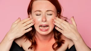 Güneş alerjisi olan kadın