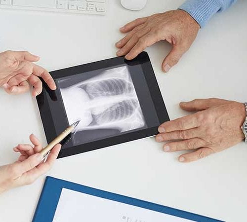جراحة سرطان الرئة (Lung cancer surgery)