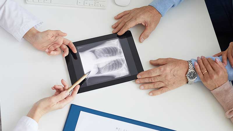 جراحة سرطان الرئة (Lung cancer surgery)