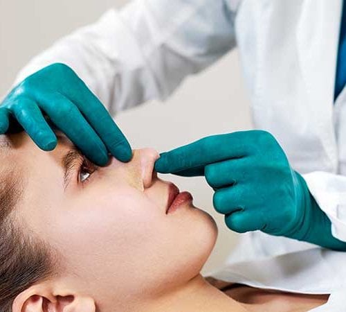 rhinoplasty