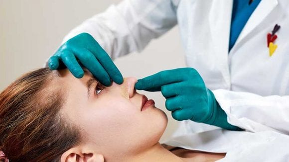 rhinoplasty