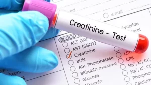 Kreatinin düşüklüğü ve yüksekliği için test