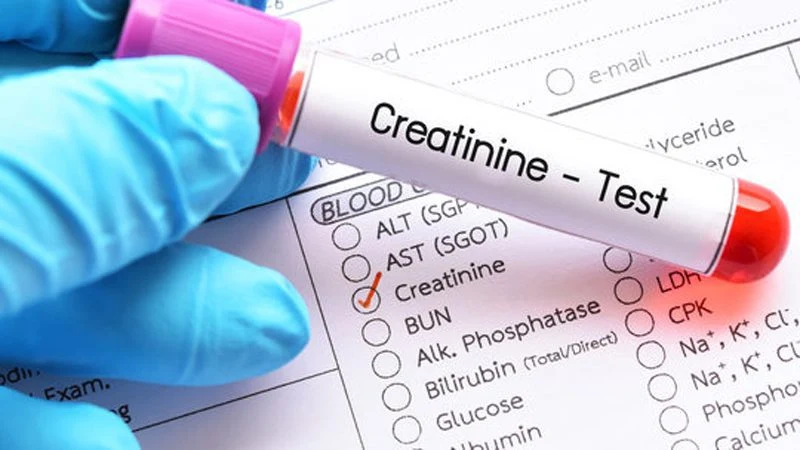 Kreatinin düşüklüğü ve yüksekliği için test