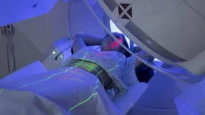 radyoterapi uygulaması alan kadın hasta