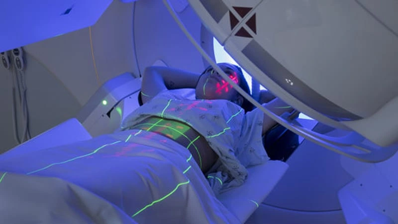 radyoterapi uygulaması alan kadın hasta