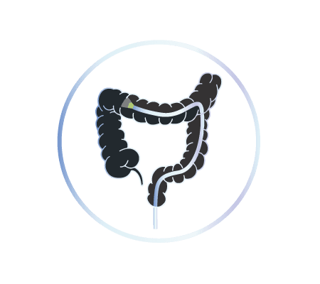 Kolonoskopi İşlemi