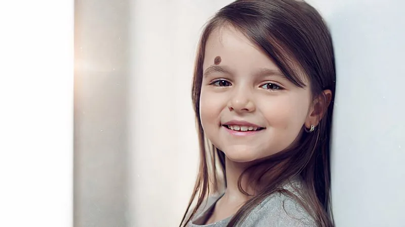 Alında doğum lekesi olan kız çocuğu