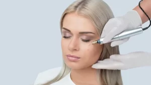 fibroblast tedavisi yapılan kadın