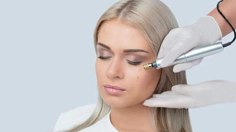 fibroblast tedavisi yapılan kadın