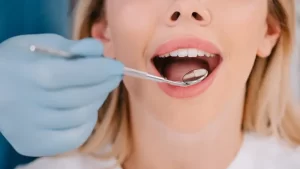 Damak Yanığı Ağız Muayenesi Olan Kadın