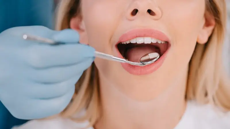 Damak Yanığı Ağız Muayenesi Olan Kadın