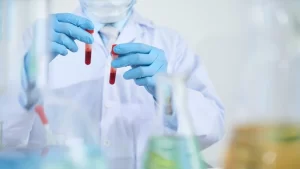 Likit Biyopsi İçin Alınan Kan Örnekleri