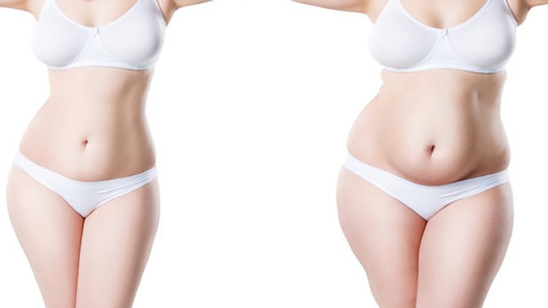 bariatric surgery before and after