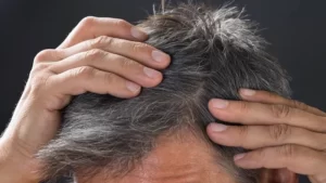 Saç Beyazlamasını Kontrol Eden Bir Erkek