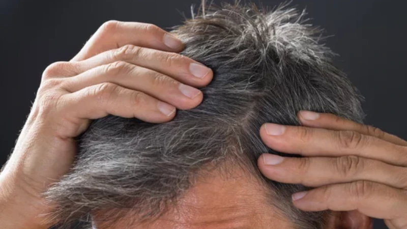Saç Beyazlamasını Kontrol Eden Bir Erkek