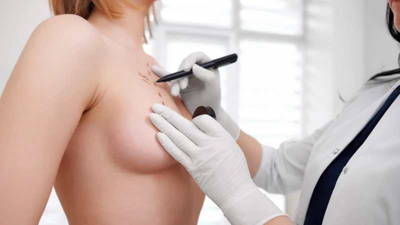 Breast Augmentation Surgery