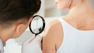 cilt hastalıkları dermatolojik muayene