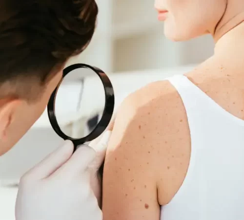 cilt hastalıkları dermatolojik muayene