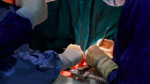 kalp ameliyatı görüntüsü