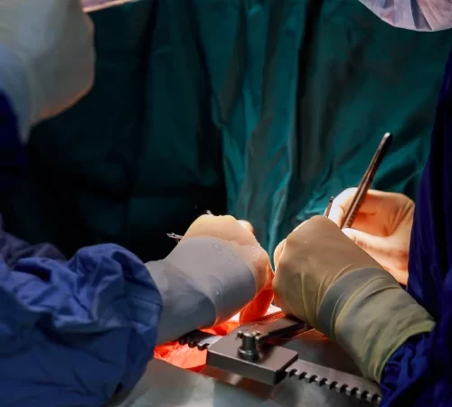 kalp ameliyatı görüntüsü