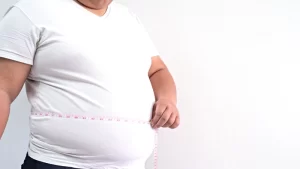 obezite cerrahisi kilolu erkek hasta