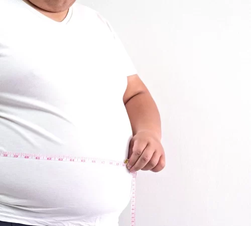 obezite cerrahisi kilolu erkek hasta