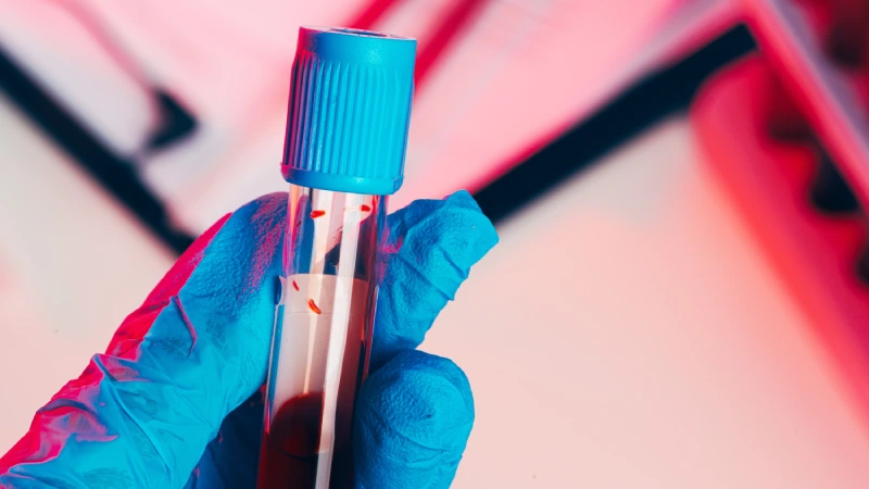 Gastrik bypass ameliyatı sonrası kansızlık ve demir eksikliği