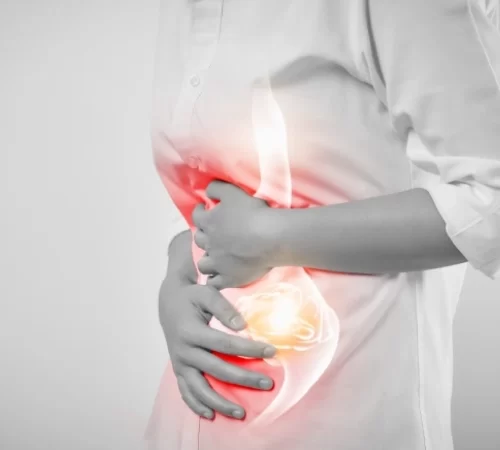 Gastrointestinal cerrahi öncesi karın ağrısı yaşayan kadın hasta