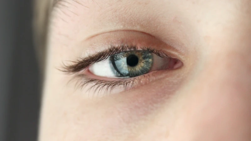 göz uçuğu yüzünden göz sulanması yaşayan kadın