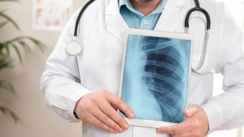 plörezi akciğer grafisi tutan doktor